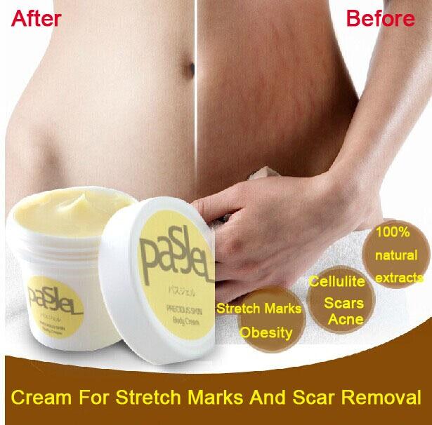 Pasjel Repair Cream - PREGNANCY STRETCH MARK REMOVAL & ANTI AGING CREAM